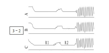 變壓器有載開關測試儀常見波形分析3 變壓器有載開關測試儀常見波形分析3